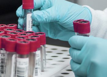 The Texas DSHS now uses a 3.5 ug/dL blood lead reference value to identify children who should receive medical and public health follow-up