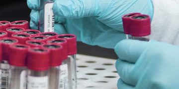 The Texas DSHS now uses a 3.5 ug/dL blood lead reference value to identify children who should receive medical and public health follow-up