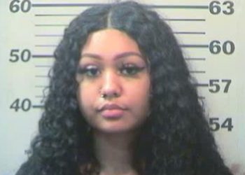 Mother, who failed to immediately seek medical attention, brought her 10-month-old baby to hospital to be treated for burns after the child was severely burned on the face, throat and mouth area because she poured hot liquid over the baby’s face!