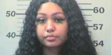 Mother, who failed to immediately seek medical attention, brought her 10-month-old baby to hospital to be treated for burns after the child was severely burned on the face, throat and mouth area because she poured hot liquid over the baby’s face!