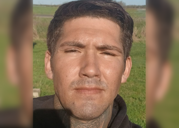 Elderly woman claims she couldn’t initially seek medical help for her injuries after her much younger partner struck a pIate of scaIding Iiquid she had just removed from the mlcrowave, inflicting severe burrns; charges