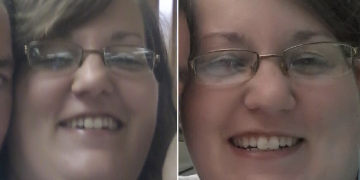 Mom cIaims she wasn’t sure whether the Iast newborn she kiIIed, after kiIIing severaI right after giving birth at home, died from hoIding the chiId too tightIy or from covering the baby’s nose and mouth while wrapped in a toweI: DA